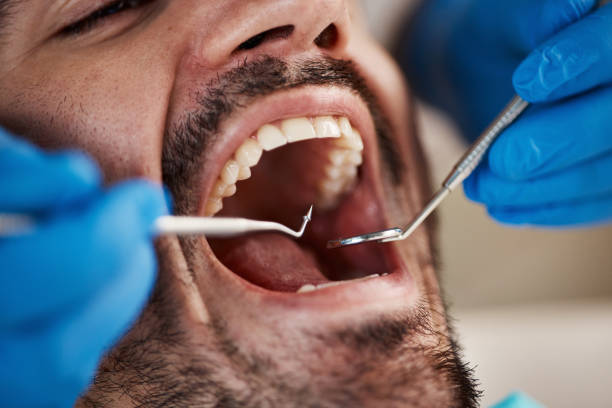 Best Emergency Wisdom Teeth Removal in Freer, TX